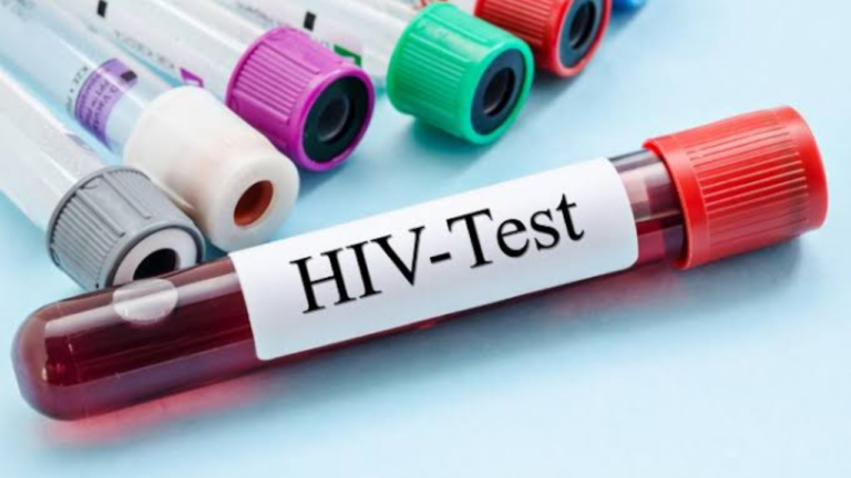 An Average of Nine People Contract HIV Each Day in Ashanti Region – Ghana AIDS Commission