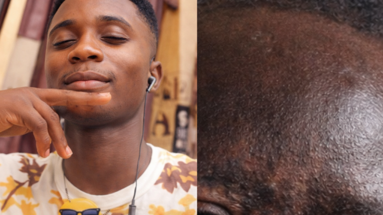 House Help Jailed Seven Years for Pouring Acid on Colleague in Ashanti Region