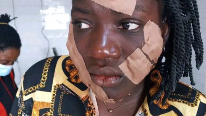 Husband Divorces Woman Accused of Razor Attack on Teenager as Court Orders _20260124_133052_0000