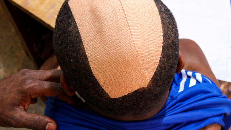 Matron Arrested After Alleged Machete Attack on 12-Year-Old Son in Afram Plains