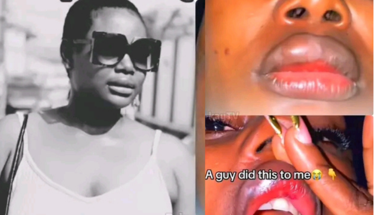 TikToker Lizzy Alleges Boyfriend Mercilessly Assaulted Her After She Discovered Cheating Messages