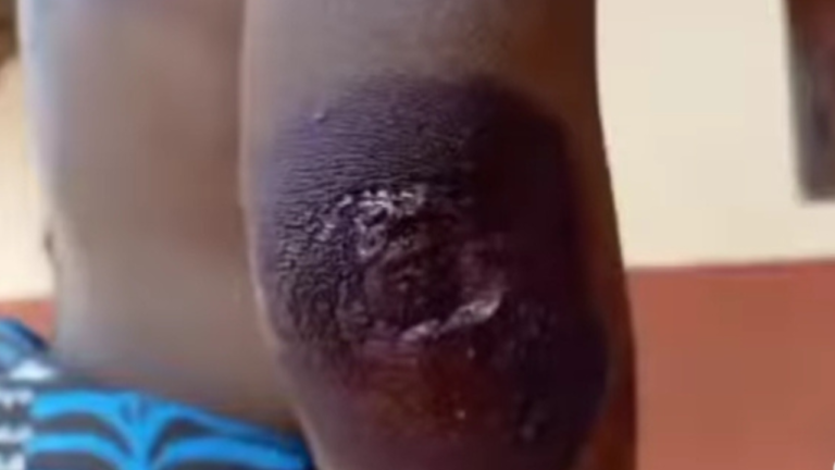 Angry Father Allegedly Ties Daughter’s Boyfriend to ‘Aboboyaa’ and Drags Him on the Ground