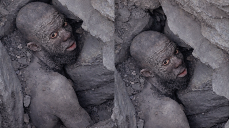 “Please Help Me” – Man Cries Out After Galamsey Pit Falls on Him